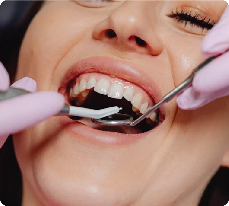 Why Your Morning Drink Might Be Quietly Wrecking Your Teeth